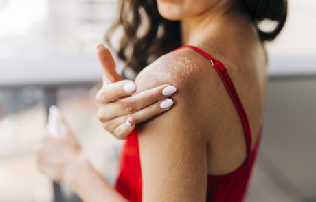 Categorias Doenças de pele